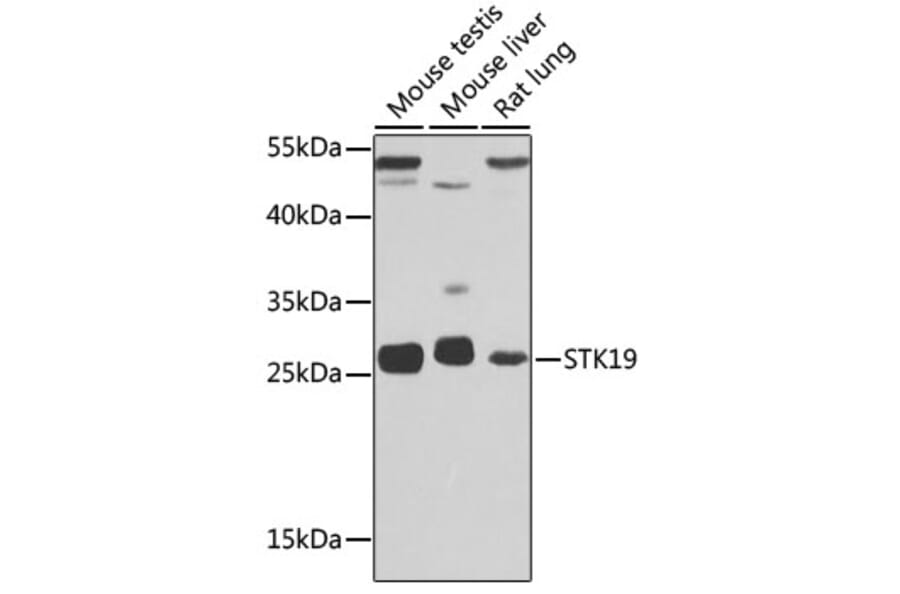 Western Blot - Anti-STK19/G11 Antibody (A92494) - Antibodies.com