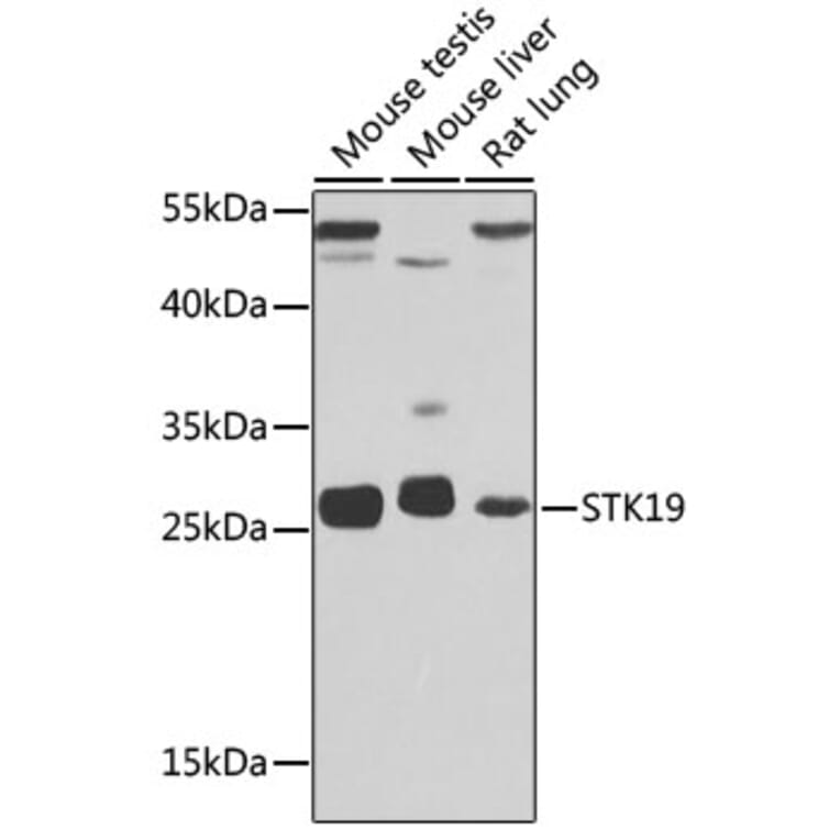 Western Blot - Anti-STK19/G11 Antibody (A92494) - Antibodies.com