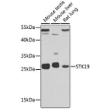Western Blot - Anti-STK19/G11 Antibody (A92494) - Antibodies.com