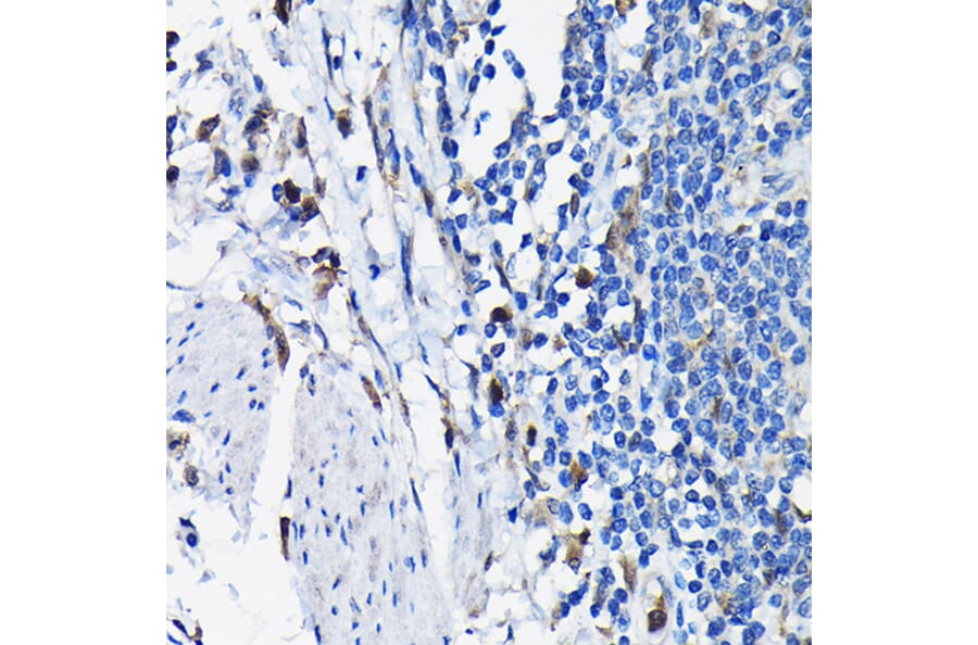 Immunohistochemistry - Anti-STK19/G11 Antibody (A92494) - Antibodies.com