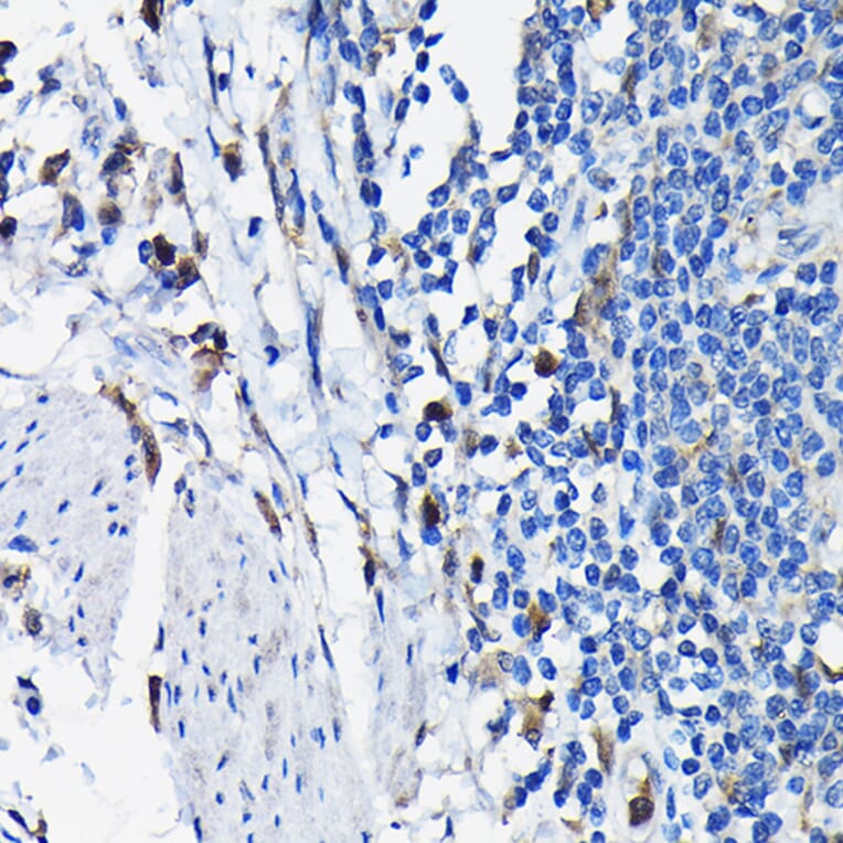 Immunohistochemistry - Anti-STK19/G11 Antibody (A92494) - Antibodies.com