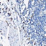 Immunohistochemistry - Anti-STK19/G11 Antibody (A92494) - Antibodies.com