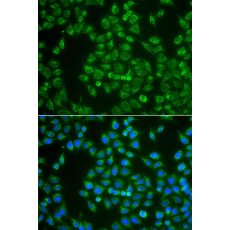 Immunofluorescence - Anti-MAP4K3 Antibody (A13375) - Antibodies.com