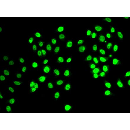 Immunofluorescence - Anti-REST Antibody (A92496) - Antibodies.com