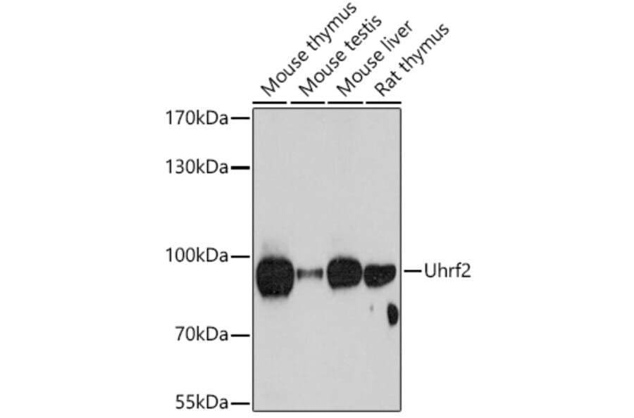 Western Blot - Anti-Uhrf2 Antibody (A92497) - Antibodies.com