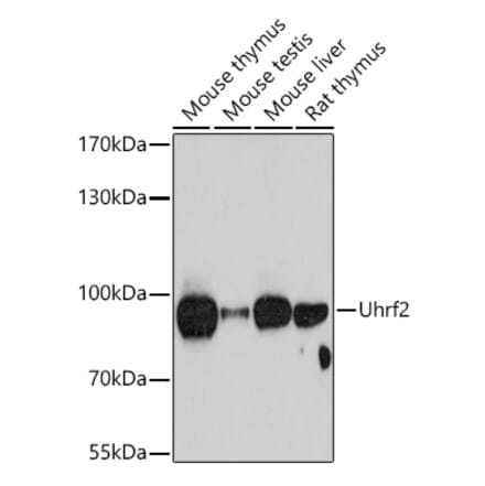 Western Blot - Anti-Uhrf2 Antibody (A92497) - Antibodies.com
