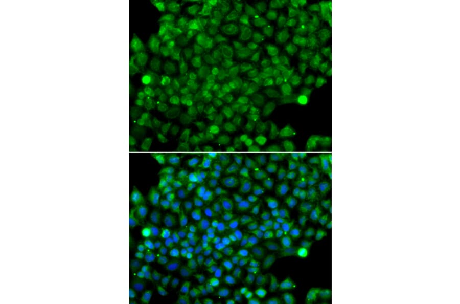 Immunofluorescence - Anti-CFHR3 Antibody (A13400) - Antibodies.com