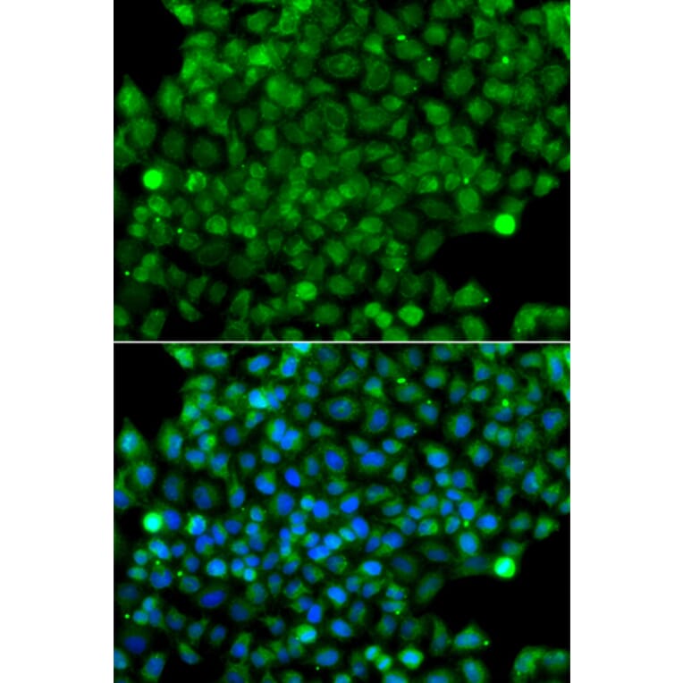 Immunofluorescence - Anti-CFHR3 Antibody (A13400) - Antibodies.com