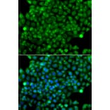 Immunofluorescence - Anti-CFHR3 Antibody (A13400) - Antibodies.com