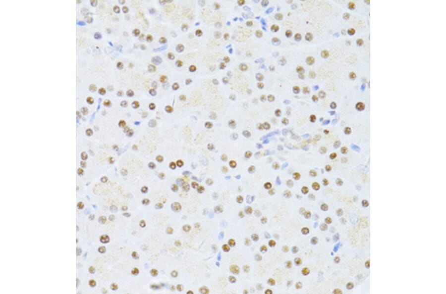 Immunohistochemistry - Anti-ER81/ETV1 Antibody (A92503) - Antibodies.com