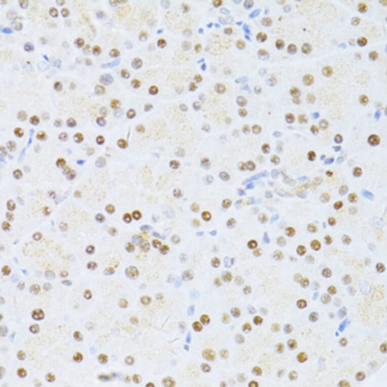 Immunohistochemistry - Anti-ER81/ETV1 Antibody (A92503) - Antibodies.com