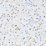 Immunohistochemistry - Anti-ER81/ETV1 Antibody (A92503) - Antibodies.com