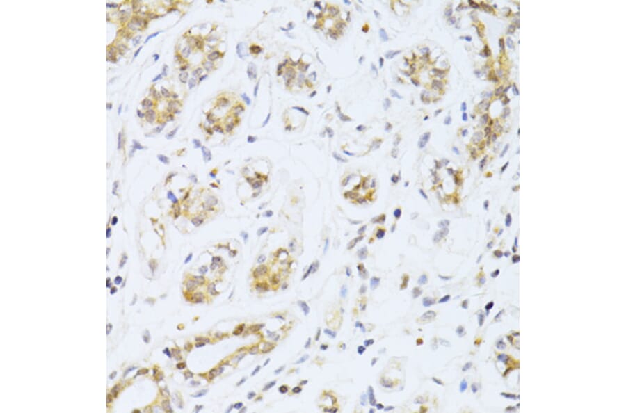 Immunohistochemistry - Anti-ER81/ETV1 Antibody (A92503) - Antibodies.com