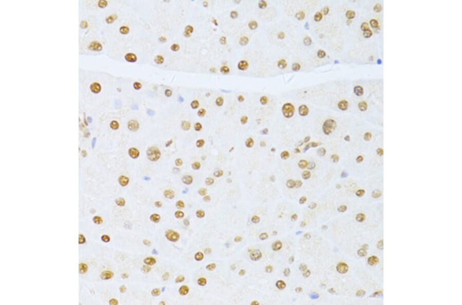 Immunohistochemistry - Anti-ER81/ETV1 Antibody (A92503) - Antibodies.com