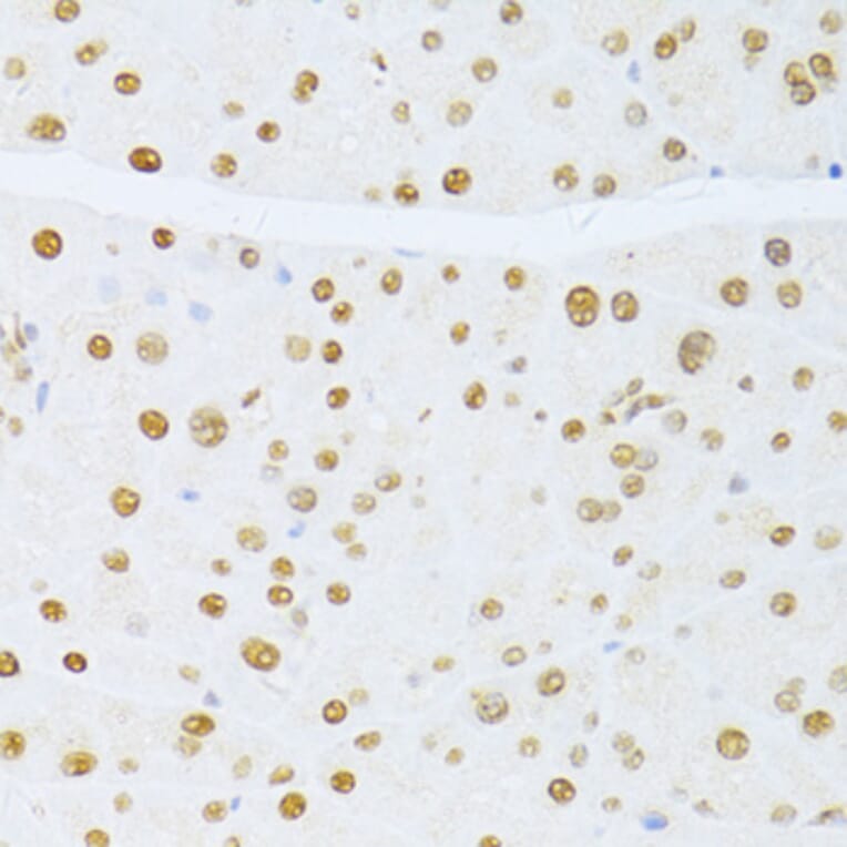 Immunohistochemistry - Anti-ER81/ETV1 Antibody (A92503) - Antibodies.com
