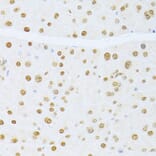 Immunohistochemistry - Anti-ER81/ETV1 Antibody (A92503) - Antibodies.com
