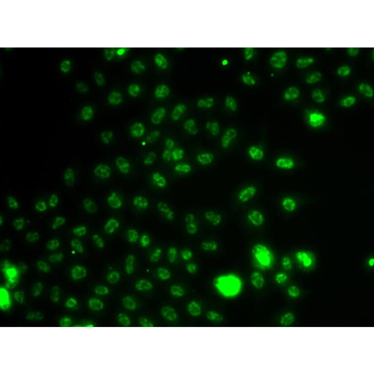 Immunofluorescence - Anti-ER81/ETV1 Antibody (A92503) - Antibodies.com