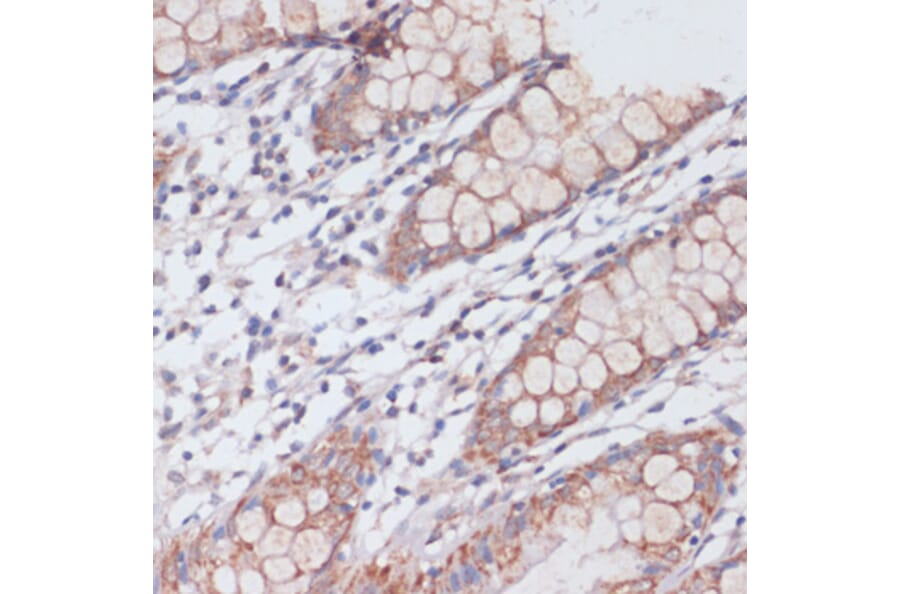 Immunohistochemistry - Anti-S1P Antibody (A92504) - Antibodies.com