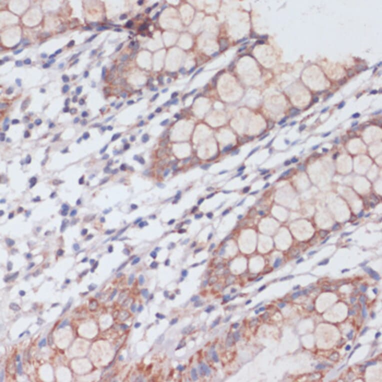 Immunohistochemistry - Anti-S1P Antibody (A92504) - Antibodies.com