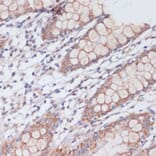 Immunohistochemistry - Anti-S1P Antibody (A92504) - Antibodies.com