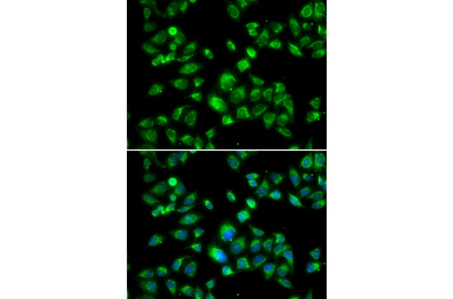 Immunofluorescence - Anti-S1P Antibody (A92504) - Antibodies.com
