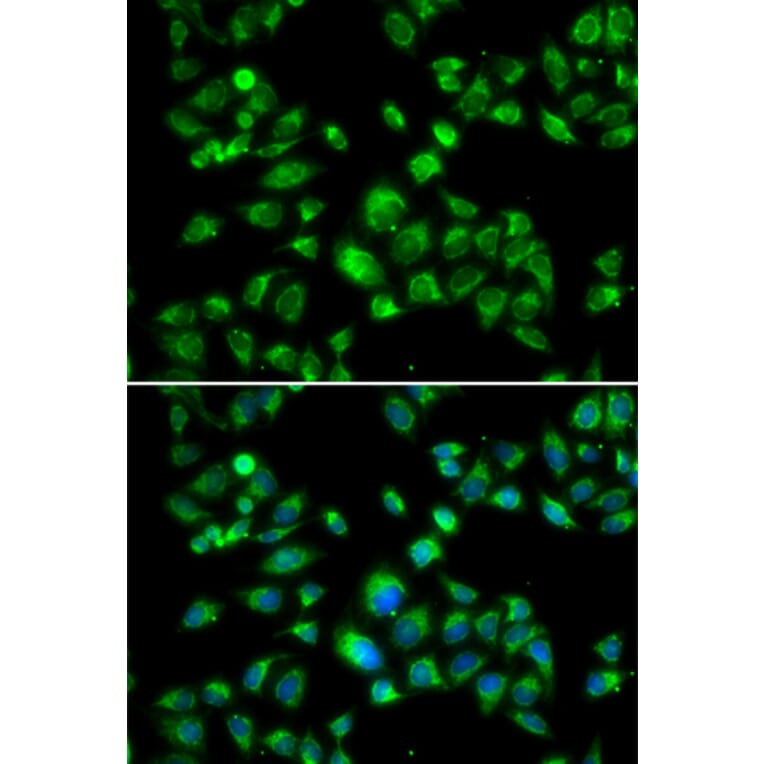 Immunofluorescence - Anti-S1P Antibody (A92504) - Antibodies.com