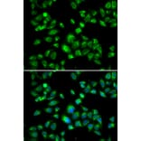 Immunofluorescence - Anti-S1P Antibody (A92504) - Antibodies.com