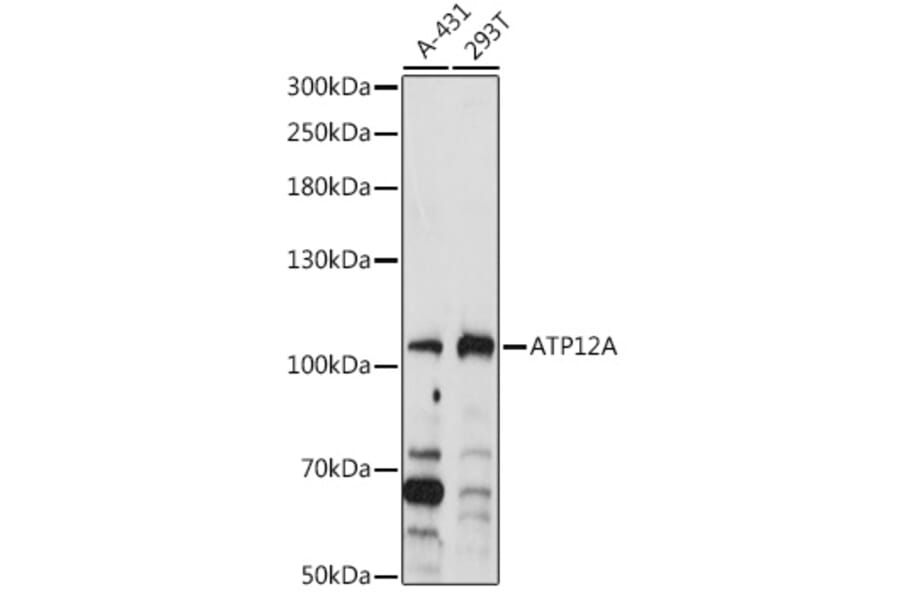 Western Blot - Anti-ATP12A Antibody (A92510) - Antibodies.com