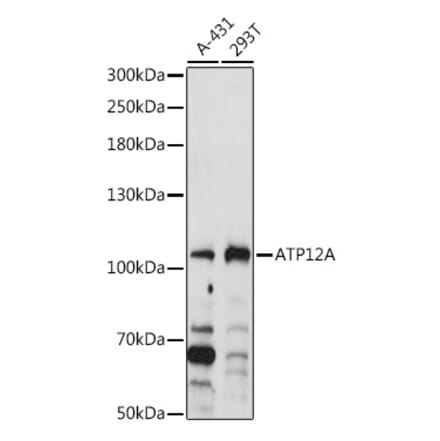 Western Blot - Anti-ATP12A Antibody (A92510) - Antibodies.com