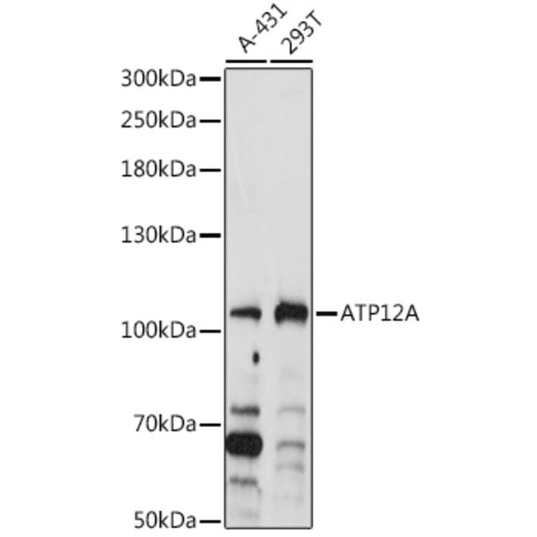 Western Blot - Anti-ATP12A Antibody (A92510) - Antibodies.com