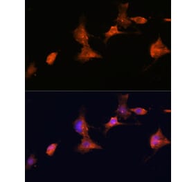 Immunofluorescence - Anti-Tuberin Antibody (A92512) - Antibodies.com