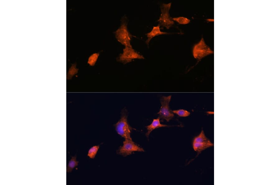 Immunofluorescence - Anti-Tuberin Antibody (A92512) - Antibodies.com
