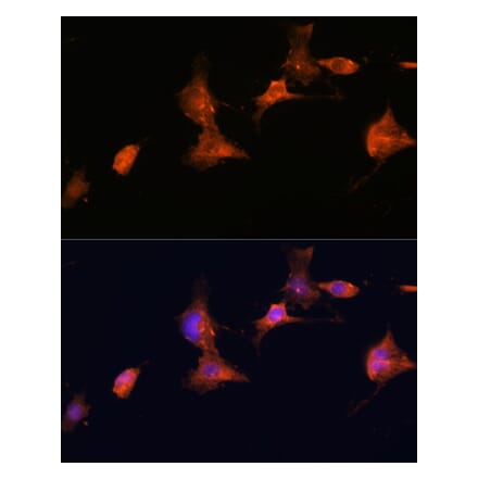 Immunofluorescence - Anti-Tuberin Antibody (A92512) - Antibodies.com