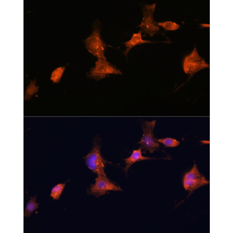 Immunofluorescence - Anti-Tuberin Antibody (A92512) - Antibodies.com