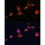 Immunofluorescence - Anti-Tuberin Antibody (A92512) - Antibodies.com