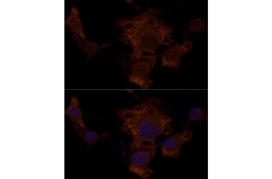 Immunofluorescence - Anti-Tuberin Antibody (A92512) - Antibodies.com