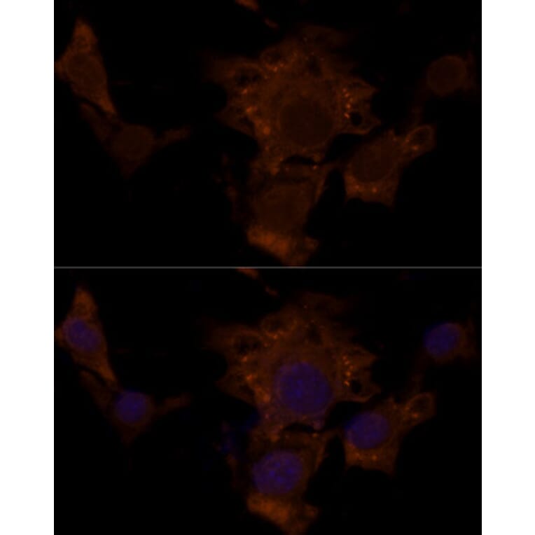 Immunofluorescence - Anti-Tuberin Antibody (A92512) - Antibodies.com