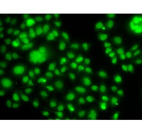 Immunofluorescence - Anti-SOX14 Antibody (A92515) - Antibodies.com