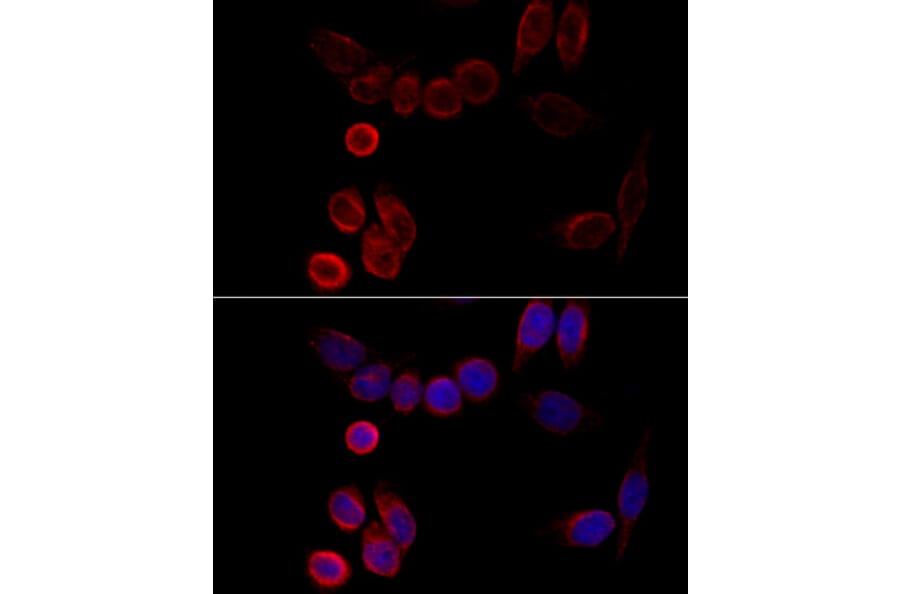 Immunofluorescence - Anti-CYP2A6 Antibody (A15044) - Antibodies.com