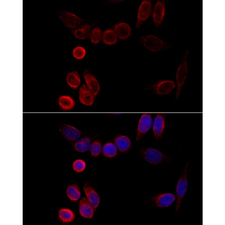 Immunofluorescence - Anti-CYP2A6 Antibody (A15044) - Antibodies.com