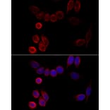 Immunofluorescence - Anti-CYP2A6 Antibody (A15044) - Antibodies.com