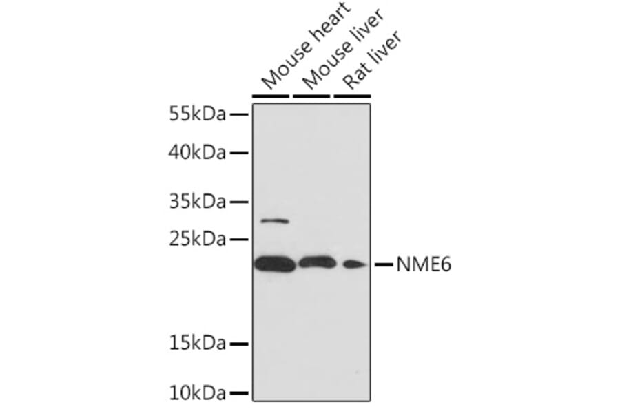 Western Blot - Anti-NME6 Antibody (A92517) - Antibodies.com