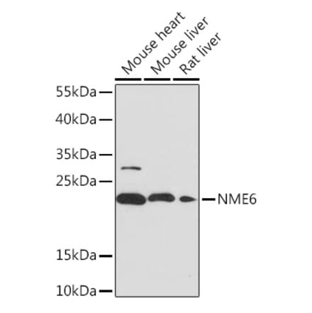 Western Blot - Anti-NME6 Antibody (A92517) - Antibodies.com