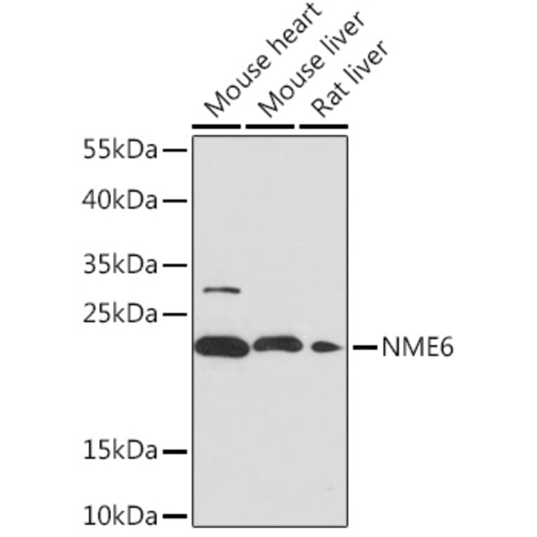 Western Blot - Anti-NME6 Antibody (A92517) - Antibodies.com