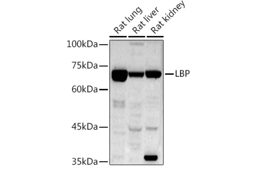 Western Blot - Anti-LBP Antibody (A92519) - Antibodies.com