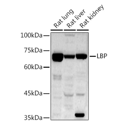 Western Blot - Anti-LBP Antibody (A92519) - Antibodies.com