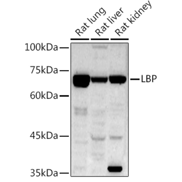 Western Blot - Anti-LBP Antibody (A92519) - Antibodies.com