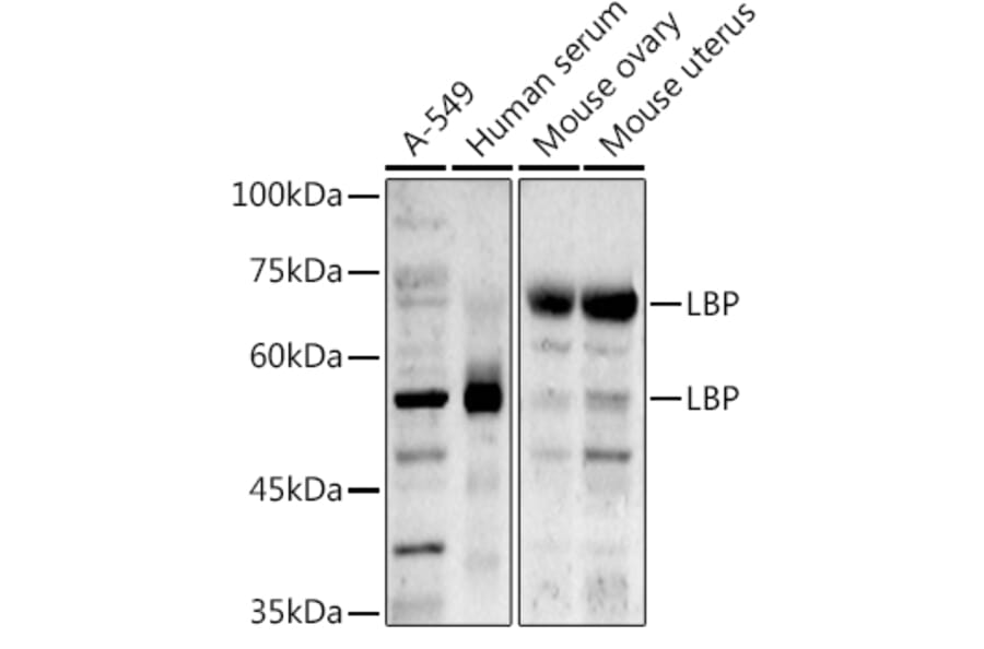 Western Blot - Anti-LBP Antibody (A92519) - Antibodies.com