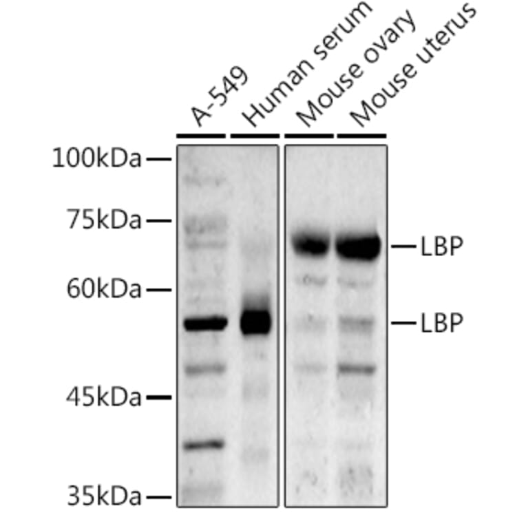 Western Blot - Anti-LBP Antibody (A92519) - Antibodies.com