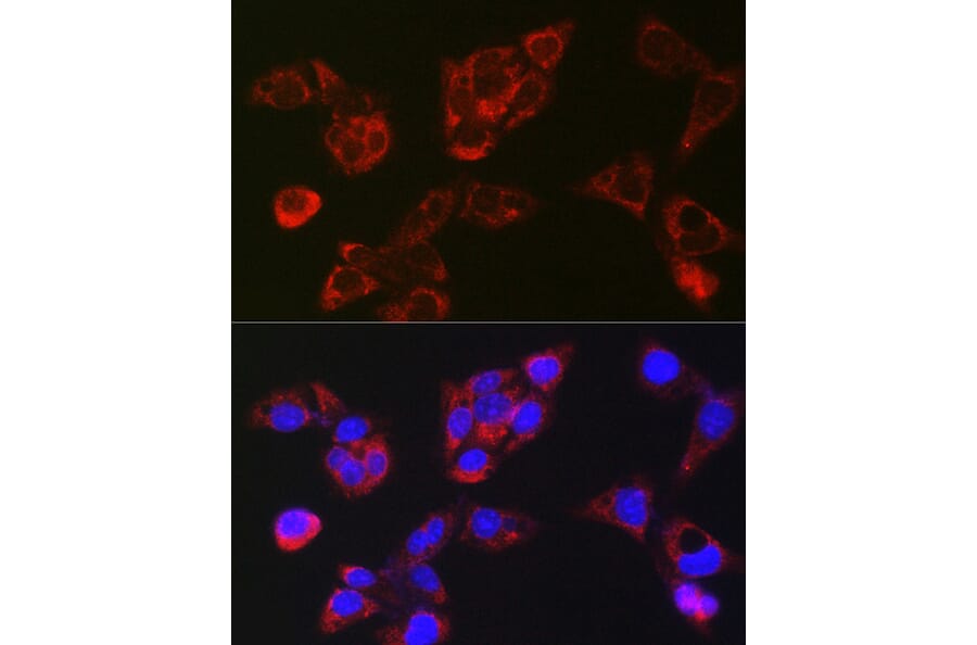 Immunofluorescence - Anti-LBP Antibody (A92519) - Antibodies.com